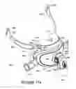 Fig. 75 - ORO-NASAL PATIENT INTERFACE