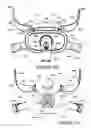 Fig. 76 - ORO-NASAL PATIENT INTERFACE