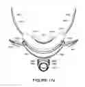 Fig. 78 - ORO-NASAL PATIENT INTERFACE