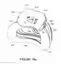 Fig. 84 - ORO-NASAL PATIENT INTERFACE
