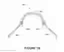 Fig. 89 - ORO-NASAL PATIENT INTERFACE