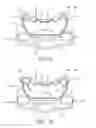 Fig. 06 - Stabilized mask