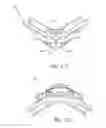 Fig. 07 - Frame and vent assembly for mask assembly