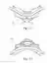 Fig. 15 - Frame and vent assembly for mask assembly