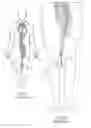 Fig. 02 - Sterile molded dispenser