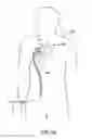 Fig. 23 - Fixed dimensional and bi-directional steerable catheter control handle