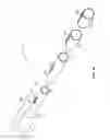 Fig. 02 - Guidewire interconnecting apparatus