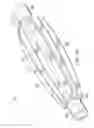 Fig. 03 - Balloon with variable pitch reinforcing fibers