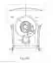 Fig. 27 - Balloon catheter assembly