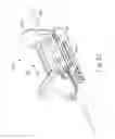 Fig. 36 - Balloon catheter assembly