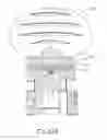 Fig. 43 - Balloon catheter assembly