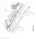 Fig. 47 - Balloon catheter assembly