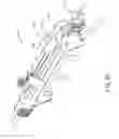 Fig. 57 - Balloon catheter assembly
