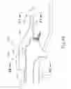 Fig. 58 - Balloon catheter assembly