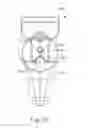 Fig. 64 - Balloon catheter assembly