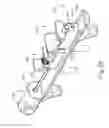 Fig. 71 - Balloon catheter assembly