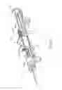 Fig. 73 - Balloon catheter assembly