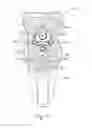 Fig. 83 - Balloon catheter assembly