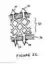 Fig. 04 - Anti-Arrhythmia Devices And Methods Of Use