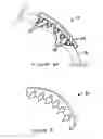 Fig. 11 - Anti-Arrhythmia Devices And Methods Of Use