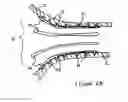Fig. 12 - Anti-Arrhythmia Devices And Methods Of Use
