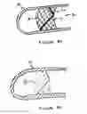 Fig. 15 - Anti-Arrhythmia Devices And Methods Of Use