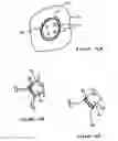 Fig. 20 - Anti-Arrhythmia Devices And Methods Of Use