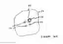 Fig. 21 - Anti-Arrhythmia Devices And Methods Of Use