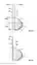 Fig. 03 - Systems and methods for a tissue expander