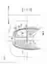 Fig. 07 - Systems and methods for a tissue expander