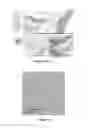 Fig. 12 - TRANSPLANTATION DEVICE AND METHOD OF USE