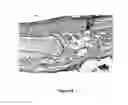 Fig. 15 - TRANSPLANTATION DEVICE AND METHOD OF USE