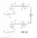 Fig. 17 - Catheter system