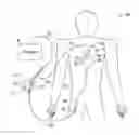 Fig. 01 - Method and apparatus for pacing during revascularization