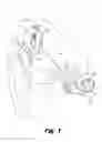 Fig. 02 - Thin profile cochlear implants