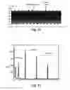 Fig. 06 - Implantable device including a stimulation lead for bioimpedance measurement