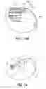 Fig. 82 - SYSTEM AND METHOD FOR OPTOGENETIC THERAPY