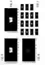 Fig. 07 - Device for determining illumination distributions for IMRT