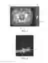 Fig. 03 - Tissue compensator thickness visualization and modification tool for use in radiation treatment planning