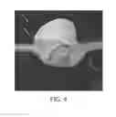Fig. 04 - Tissue compensator thickness visualization and modification tool for use in radiation treatment planning