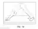 Fig. 19 - Heart shaped exercise device