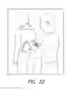 Fig. 22 - Heart shaped exercise device
