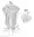 Fig. 02 - Lacrosse stick with quickly adjustable pocket