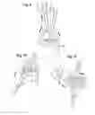 Fig. 05 - Lacrosse stick with quickly adjustable pocket