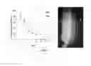 Fig. 06 - Microfluidic separation device, separation method using the same and kit for separating circulating rare cells from blood using the same