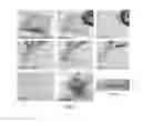 Fig. 10 - Microfluidic separation device, separation method using the same and kit for separating circulating rare cells from blood using the same