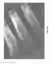 Fig. 46 - Systems, devices, and/or methods for manufacturing castings