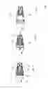Fig. 07 - MATERIAL-REMOVING MACHINE TOOL, TOOL SET AND METHOD FOR PRODUCING A CYLINDER HAVING A BLIND AND/OR STEPPED BORE