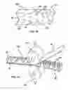 Fig. 03 - Method of fabricating roll-bonded expanded load-bearing aluminum laminate structural elements for vehicle