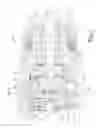 Fig. 08 - Tool having multi-speed compound planetary transmission